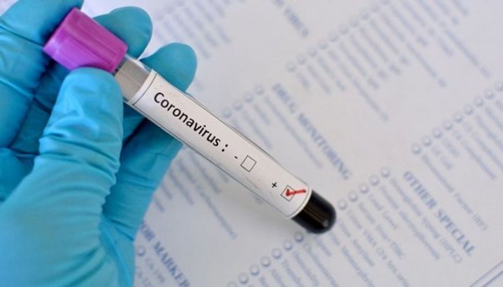 Новости о коронавирусе: за прошедшие сутки в России диагностировано 30 случаев заражения