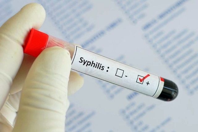 Заболеваемость сифилисом в Татарстане в этом году выросла на 18,6%