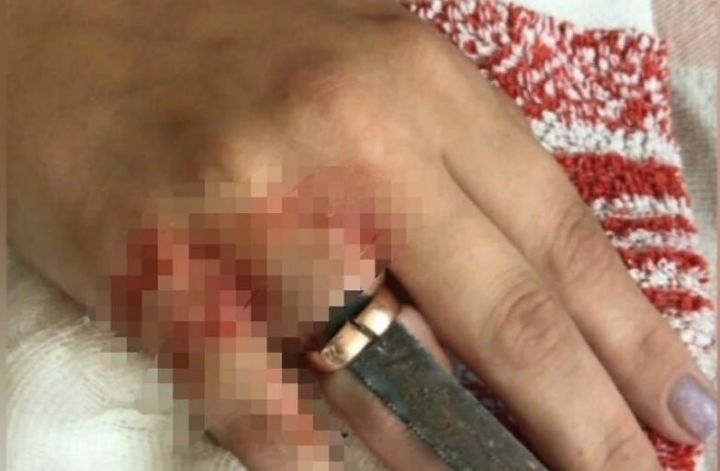 Жительница Казани пострадала из-за обручального кольца